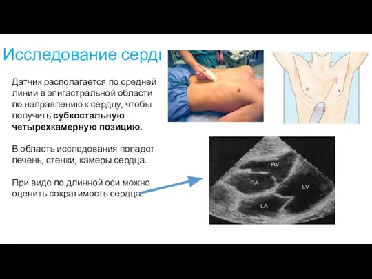 Исследование сердца Датчик располагается по средней линии в эпигастральной области по