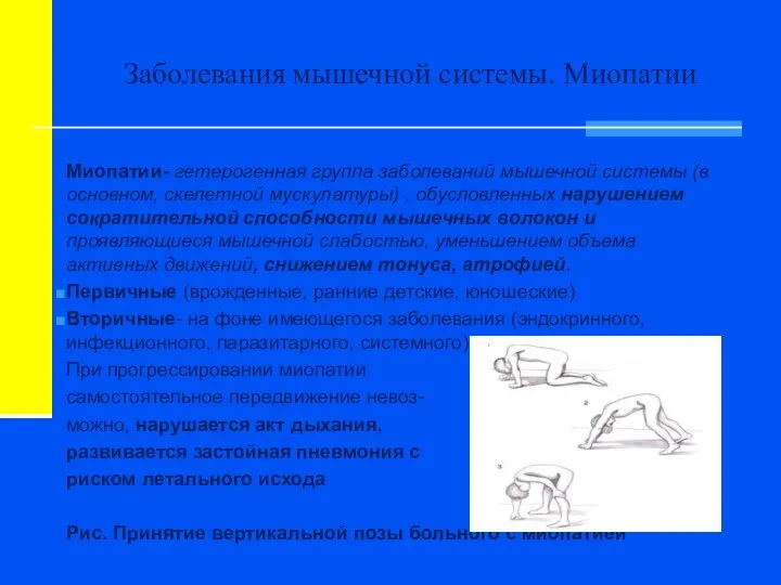 Заболевания мышечной системы. Миопатии Миопатии- гетерогенная группа заболеваний мышечной системы (в