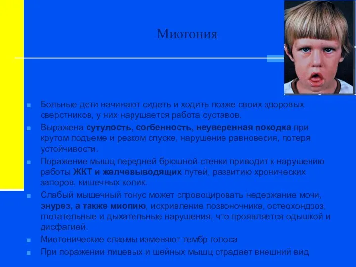 Миотония Больные дети начинают сидеть и ходить позже своих здоровых сверстников,