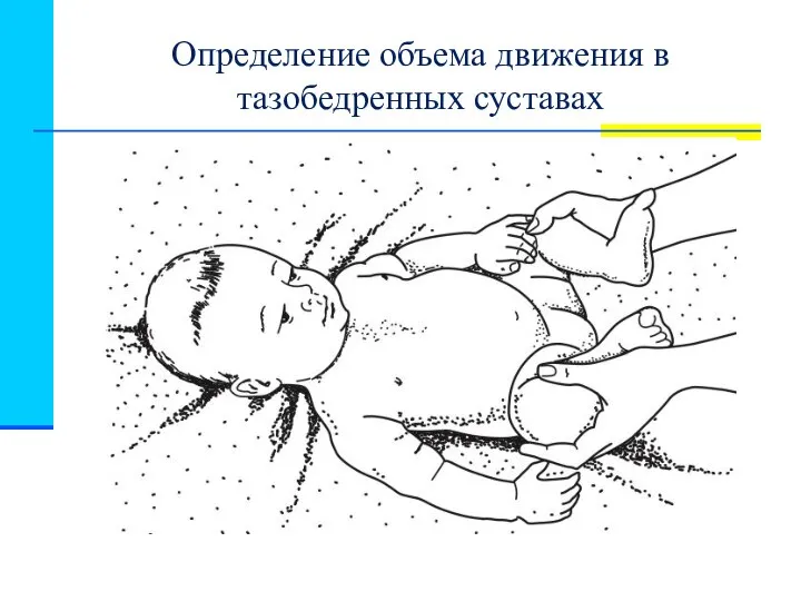 Определение объема движения в тазобедренных суставах