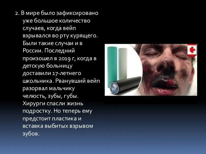 2. В мире было зафиксировано уже большое количество случаев, когда вейп