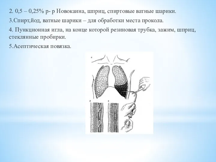 2. 0,5 – 0,25% р- р Новокаина, шприц, спиртовые ватные шарики.