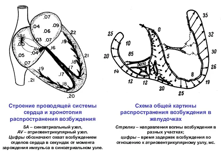 Схема общей картины распространения возбуждения в желудочках Стрелки – направления волны