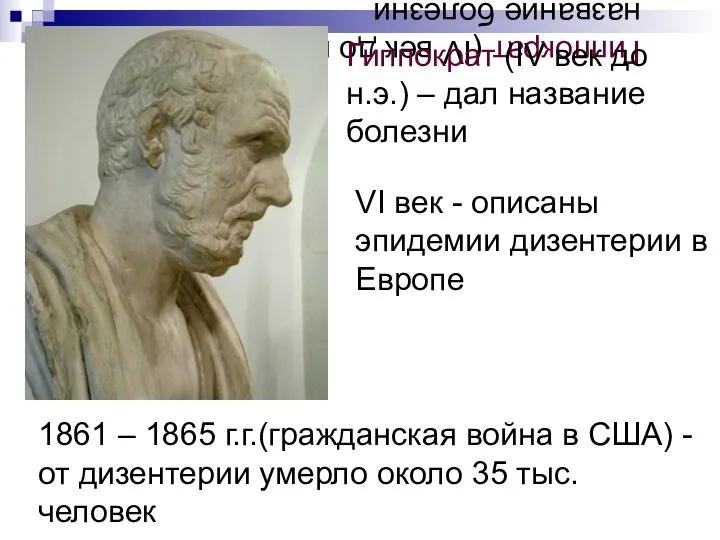 Гиппократ (IV век до н.э.) – дал название болезни Гиппократ (IV