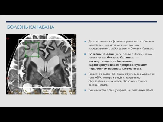 БОЛЕЗНЬ КАНАВАНА Дело возникло на фоне исторического события – разработки лекарства