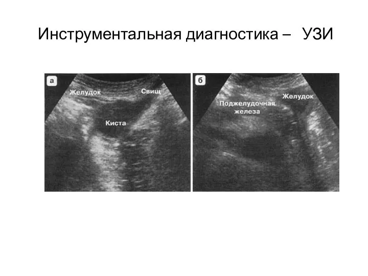 Инструментальная диагностика – УЗИ