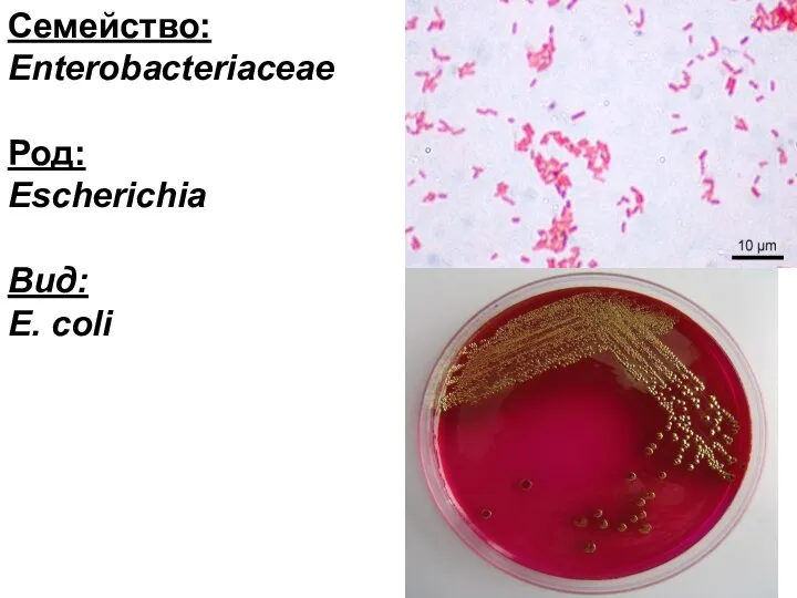 Семейство: Enterobacteriaceae Род: Escherichia Вид: E. coli