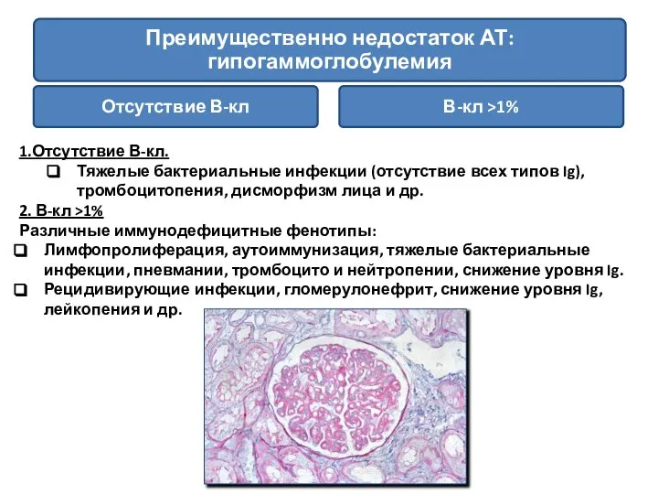 1.Отсутствие В-кл. Тяжелые бактериальные инфекции (отсутствие всех типов Ig), тромбоцитопения, дисморфизм