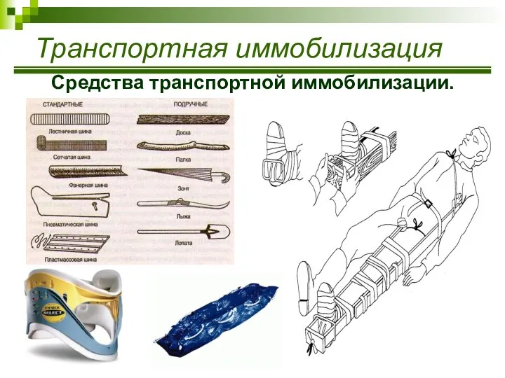 Средства транспортной иммобилизации. Транспортная иммобилизация