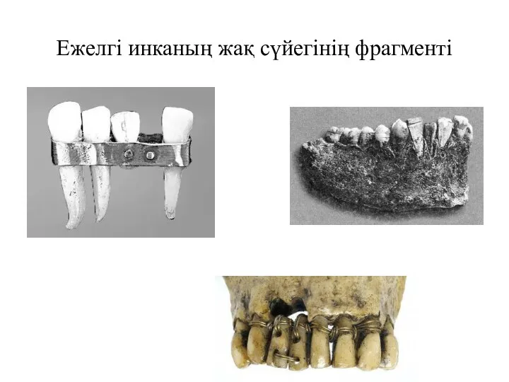 Ежелгі инканың жақ сүйегінің фрагменті