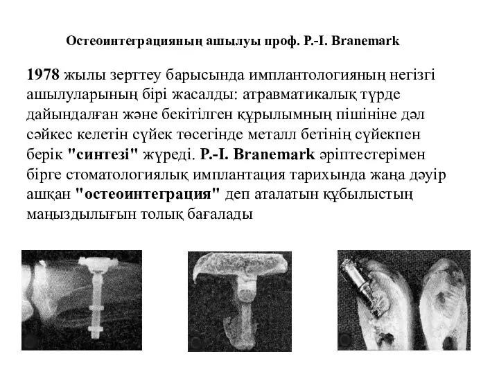 1978 жылы зерттеу барысында имплантологияның негізгі ашылуларының бірі жасалды: атравматикалық түрде