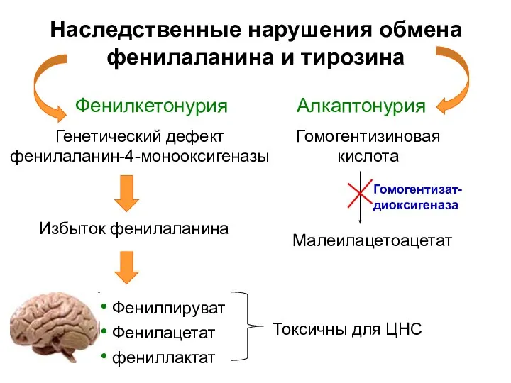 Наследственные нарушения обмена фенилаланина и тирозина Генетический дефект фенилаланин-4-монооксигеназы Фенилкетонурия Фенилпируват