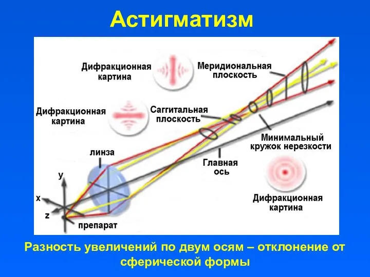 Астигматизм Разность увеличений по двум осям – отклонение от сферической формы