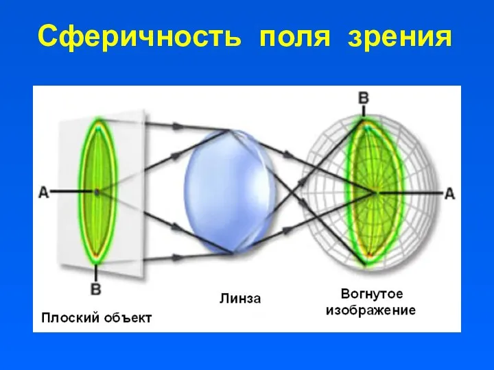 Сферичность поля зрения