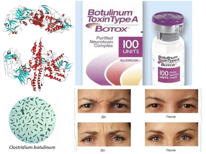 Ботулотоксин, ботокс (ботулинический токсин, токсин ботулизма) — нейротоксин белковой природы, вырабатываемый
