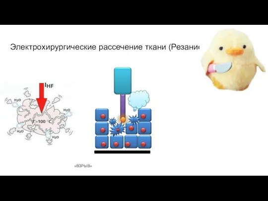 Электрохирургические рассечение ткани (Резание) «ВЗРЫВ»