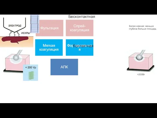 Бесконтактная Контактная Более нежная: меньше глубина больше площадь >200Вт