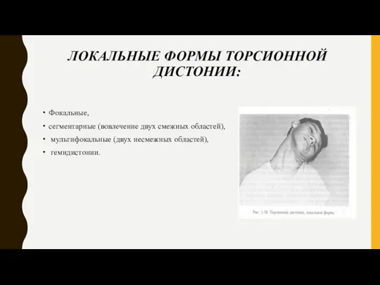 ЛОКАЛЬНЫЕ ФОРМЫ ТОРСИОННОЙ ДИСТОНИИ: Фокальные, сегментарные (вовлечение двух смежных областей), мультифокальные (двух несмежных областей), гемидистонии.