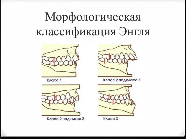 Морфологическая классификация Энгля