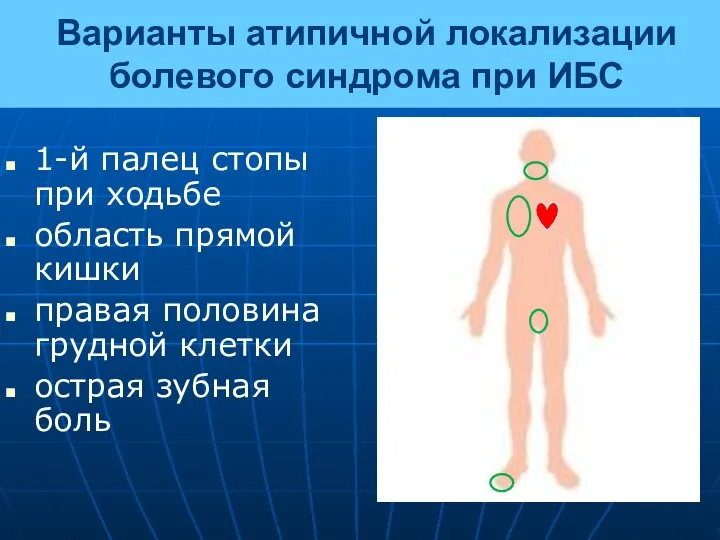 Варианты атипичной локализации болевого синдрома при ИБС 1-й палец стопы при