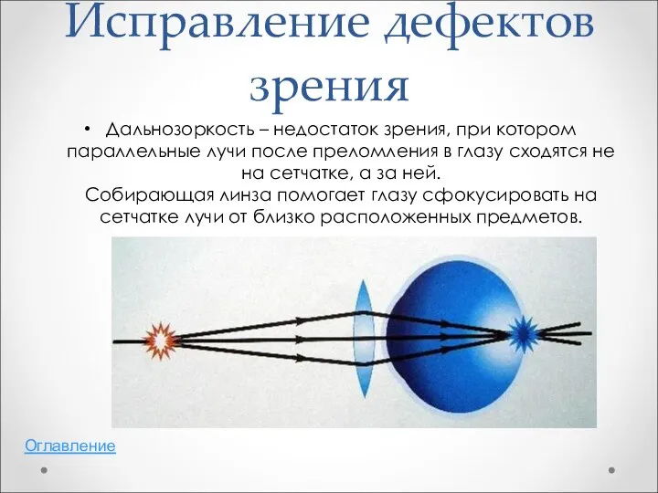 Исправление дефектов зрения Дальнозоркость – недостаток зрения, при котором параллельные лучи