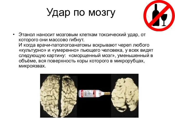 Удар по мозгу Этанол наносит мозговым клеткам токсический удар, от которого