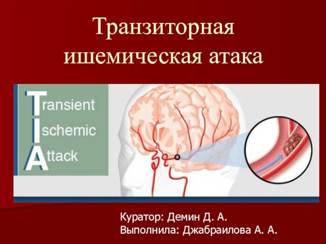 Транзиторная атака